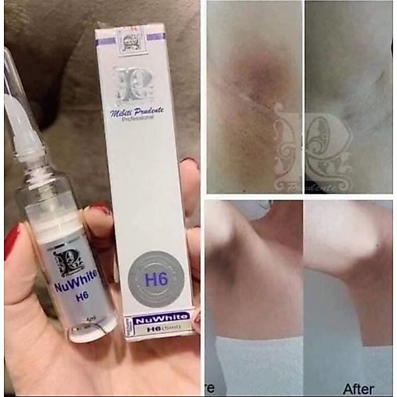 Nuwhite H6 Made in USA For Dark Armpits