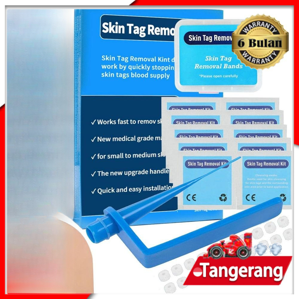 Skin Tag Removal Kit Skin Tag Remover Wart Remover Obat Kutil Penghilang Wart Removal Kit High Quali