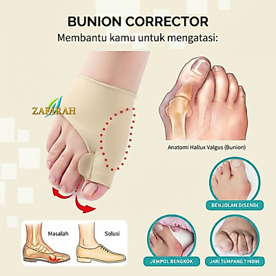 Bunion Corrector | Bunion Pelurus Jempol Kaki | Sleeve Korektor Tulang Jempol Bunion Hallux Valgus