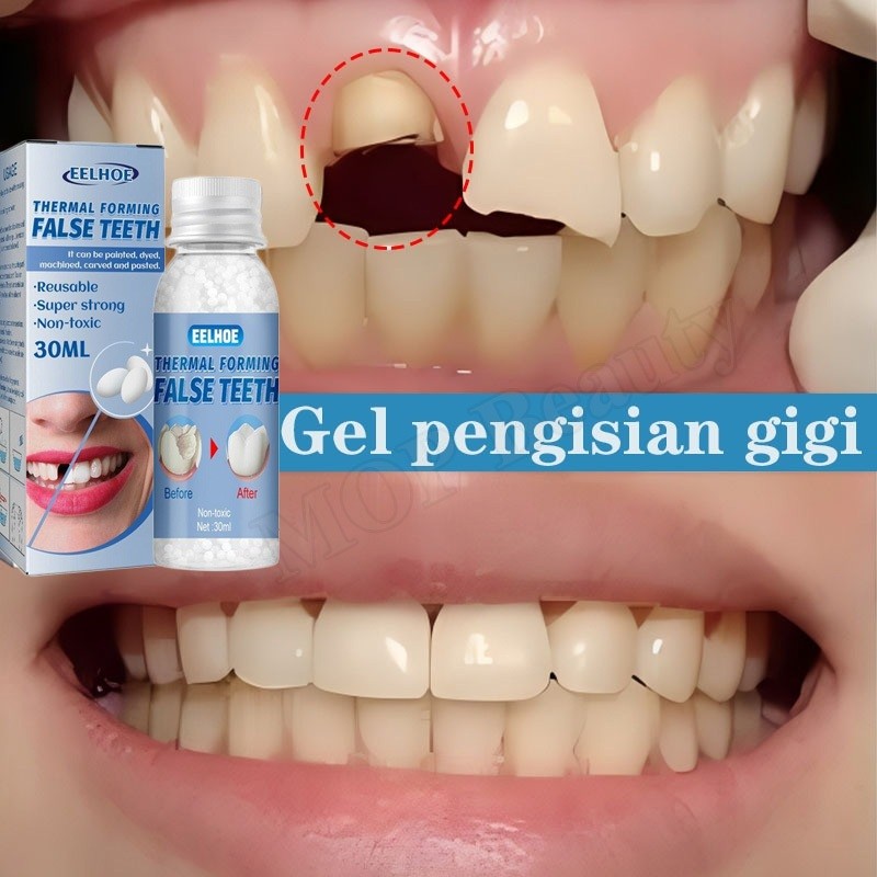 Gigi Palsu Penambal gigi berlubang Gigi Penambal Gigi Isi Gigi Palsu Penambal gigi berlubang Gigi pa
