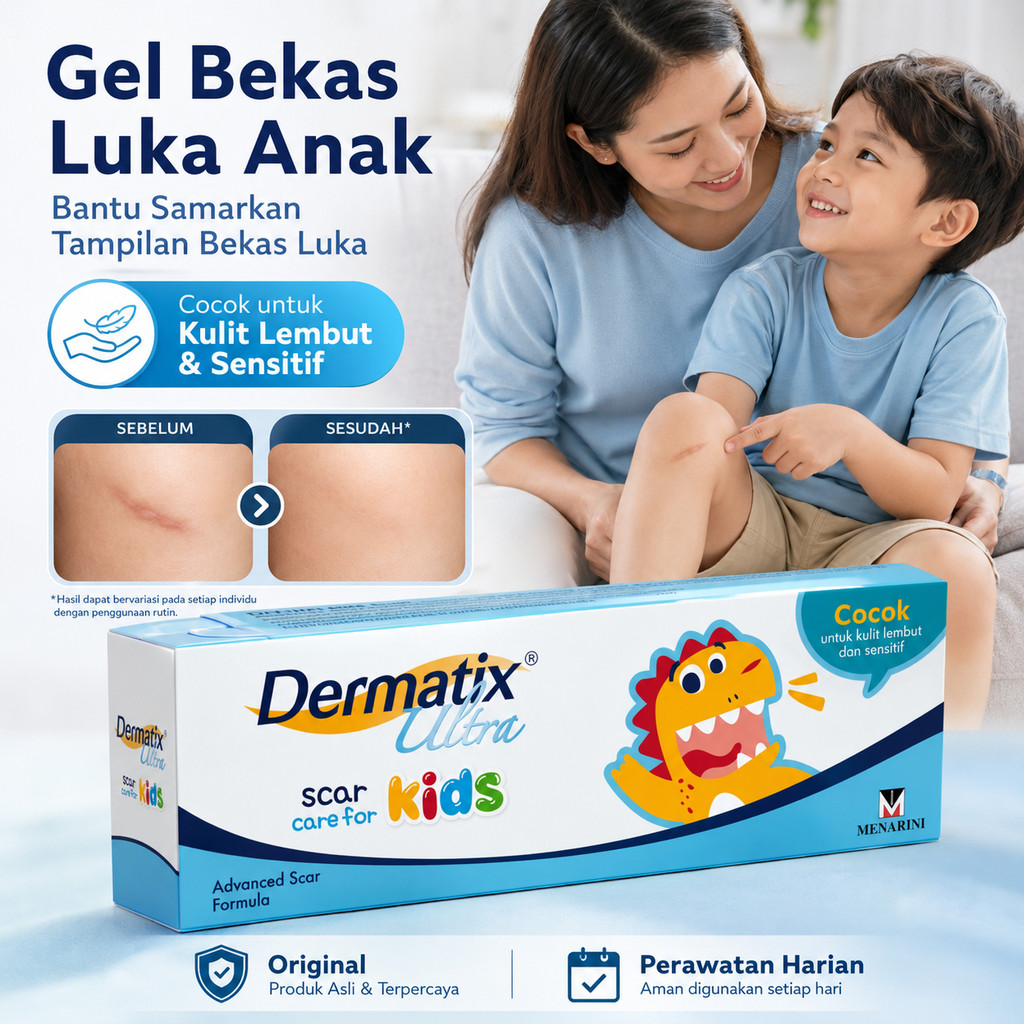 Dermatix Ultra Kids Scar Care Gel Anak Original Bantu Samarkan Tampilan Bekas Luka Anak, Gel Perawat