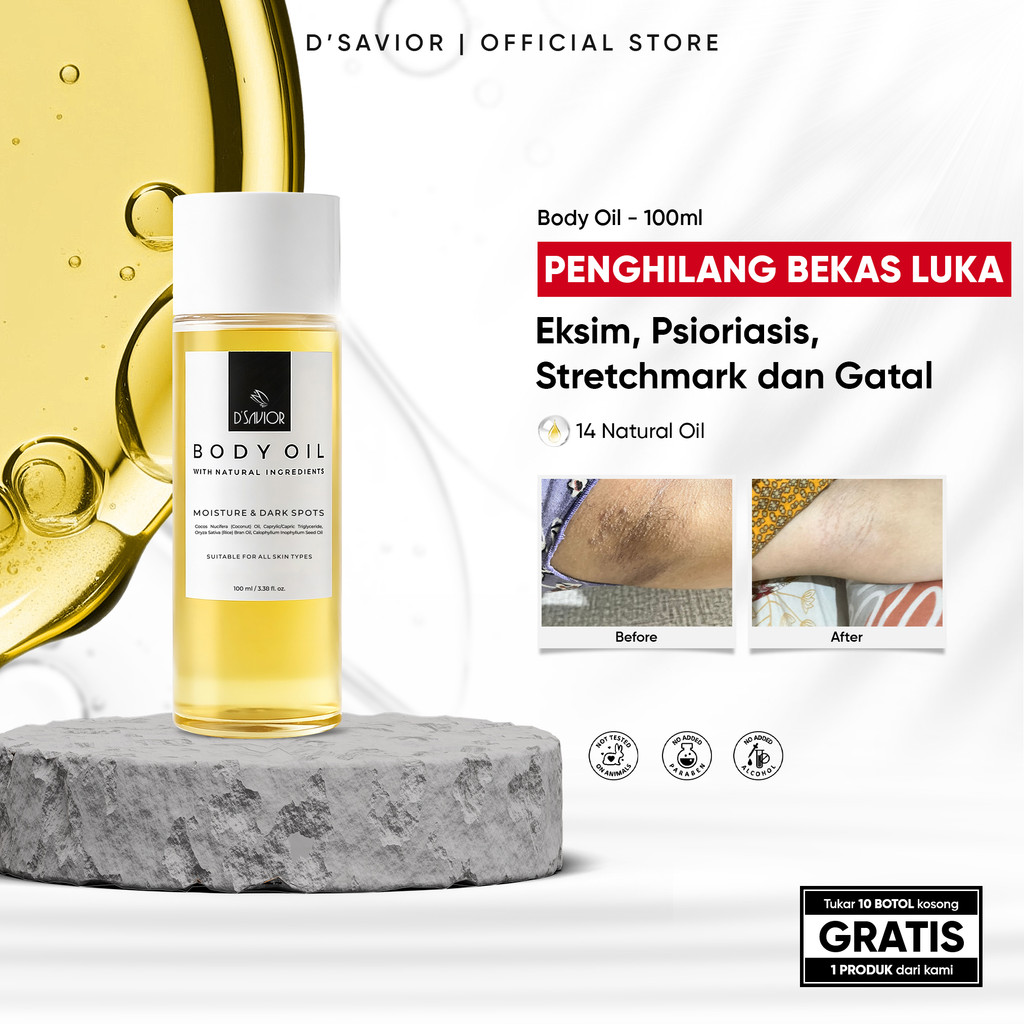 [NEW SIZE] D’SAVIOR Body Oil 100ml | Penghilang Bekas Luka, Eksim, Psioriasis, Stretchmark dan Gatal