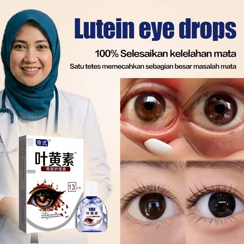 Obat Tetes Mata Katarak & Mata Minus Yehuangsu 13ml – Herbal Alami Redakan Mata Merah, Kering, Lelah