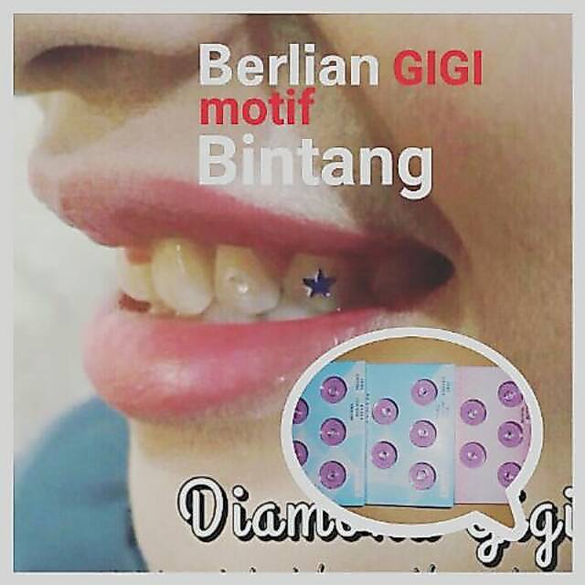 Berlian gigi / diamond model BINTANG