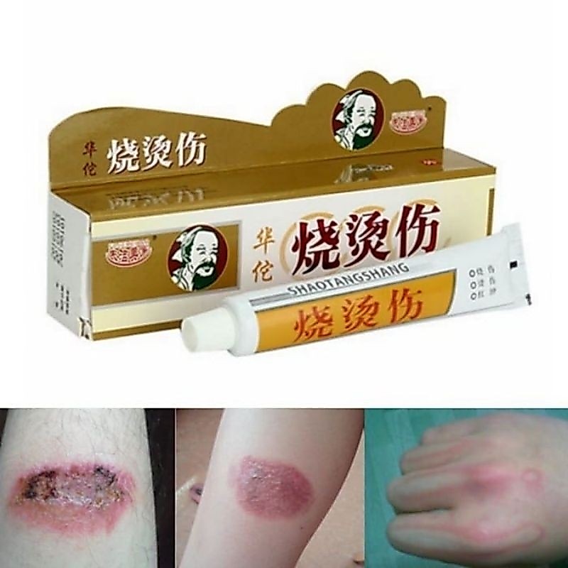 SALEP OBAT LUKA BAKAR / MELEPUH KELOID HUATUO