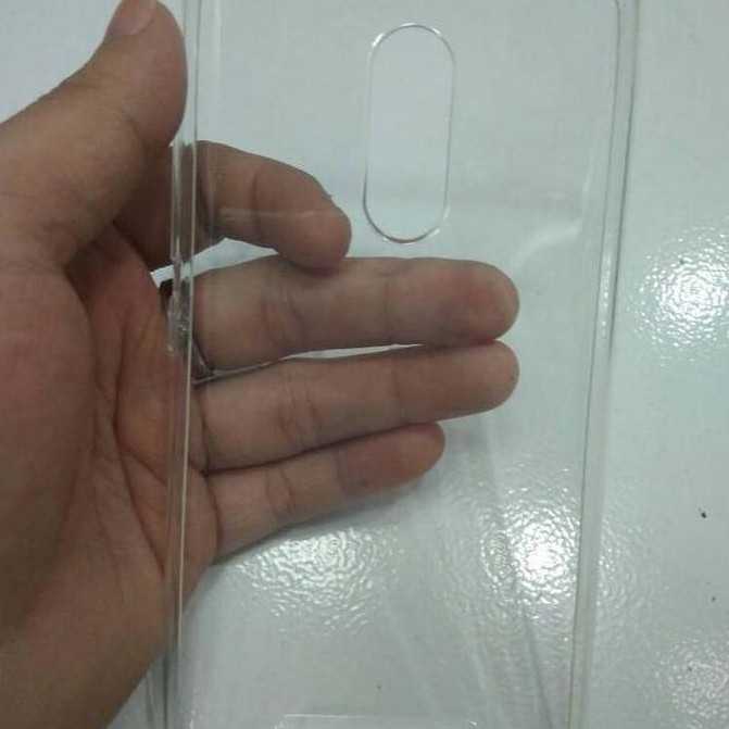SOFTCASE Tebal Redmi note 3 pro Special Edition (Kate)