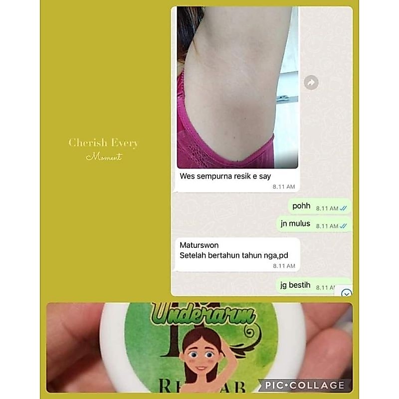 Magic Underarm Original Rhajab | Pemutih Lipatan CREAM LIPATAN PALING AMPUH