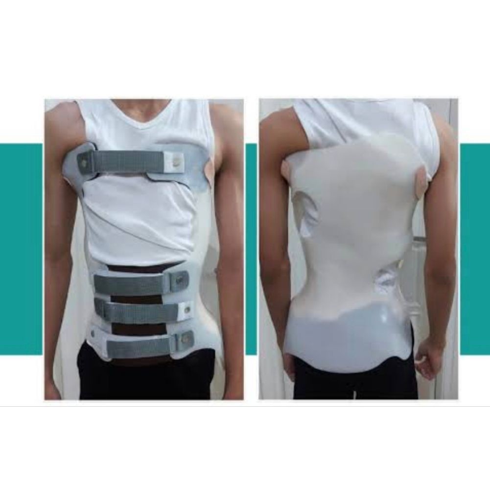 mso scoliosis brace