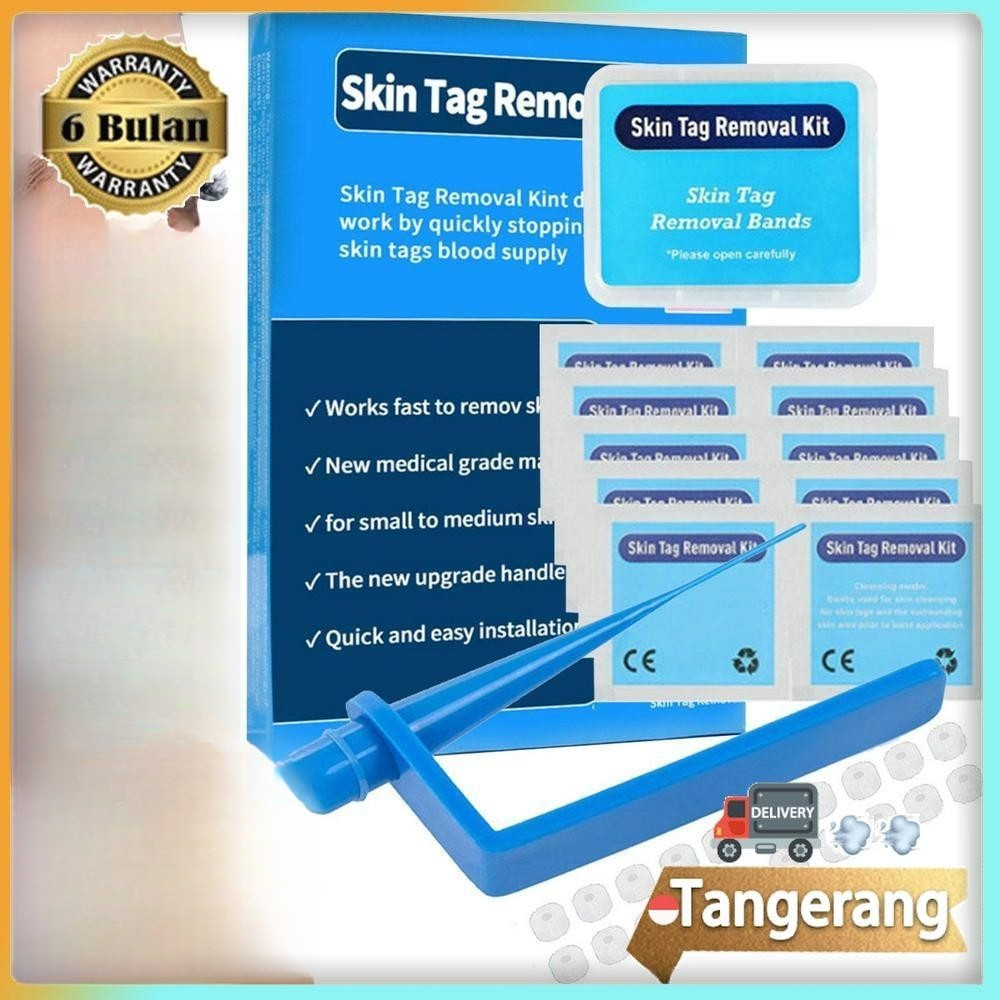 Skin Tag Removal Kit / Skin Tag Remover / Wart Remover / Wart Removal Kit Obat Kutil Penghilang