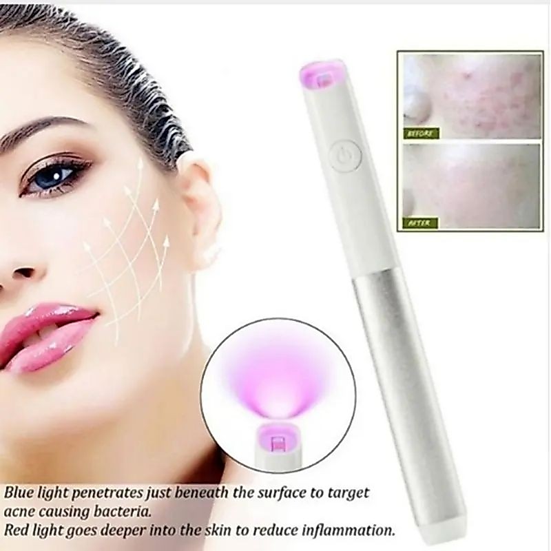 Alat laser terapi keloid jerawat selulit