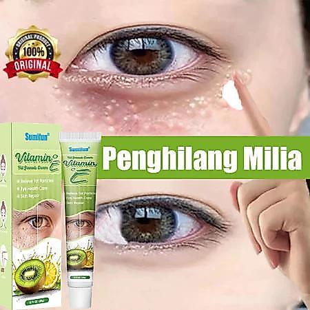Krim Penghilang Milia Obat Milia Di Bawah Mata Cream Vitamin E Eye Cream Penghilang Milia Syringoma