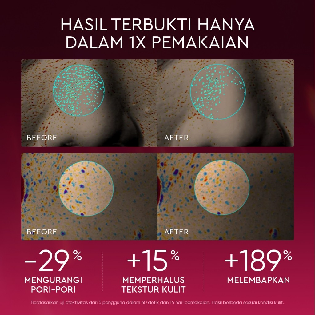 ELFORMULA Bundle 2pcs Intensive Peeling Solution - Peeling Serum Dark Spot Glass Skin Eksfoliasi Waj