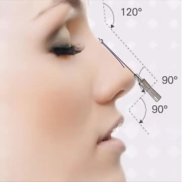 Ella Benang Hidung Thread Lift  PDO-PCL   19g*60mm-9g*38mm   2benang