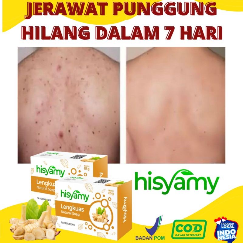 [COD] Sabun Jerawat Punggung Herbal Lengkuas Paling Ampuh Hisyamy Penghilang Penyakit Obat Panu Jamu