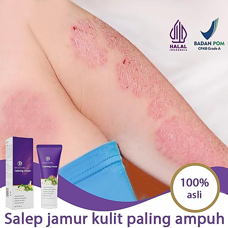 【BPOM】Obat kurap salep eksim obat gatal selangkangan salep gatal china paling ampuh salep gatel 20g