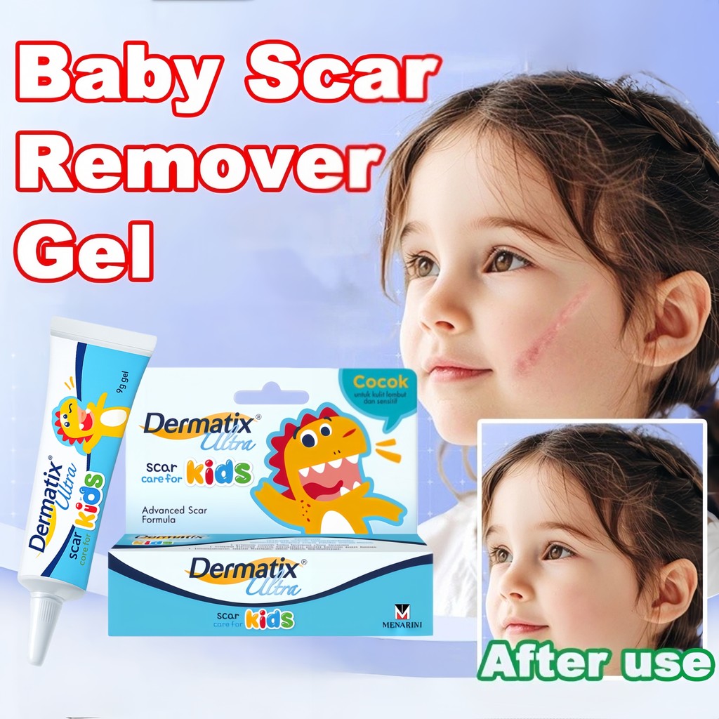 Dermatix Ultra Kids 9g Asli Ampuh Hapus Bekas Luka Bakar Operasi Noda Hitam Stretch Mark Aman Anak D