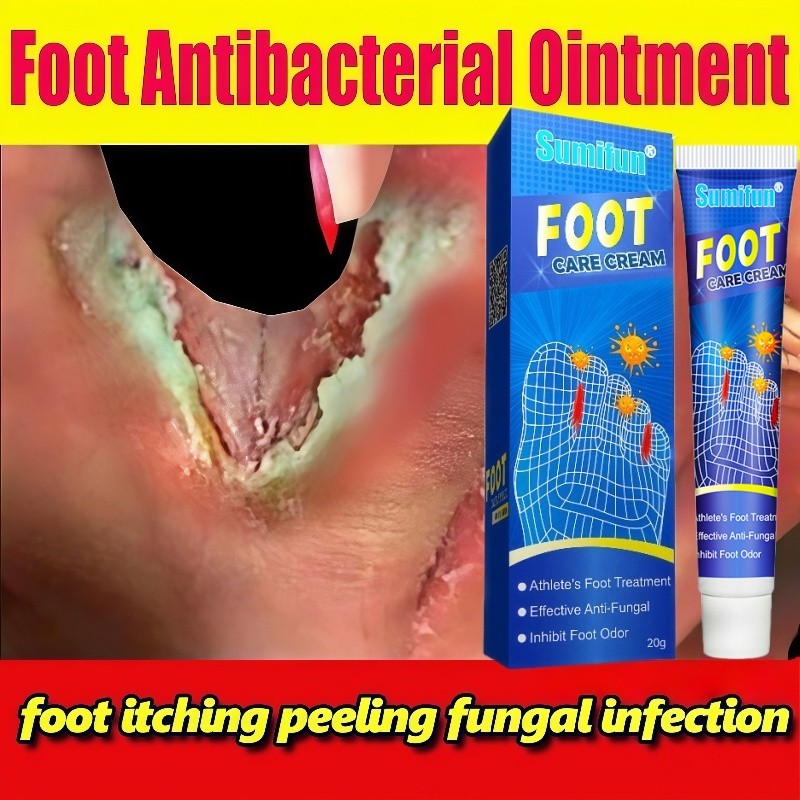 obat kaki rayapan Obat Kaki Pecah 20g Obat Telapak Kaki Rayapan obat jamur kaki Krim Pengelupas Kuli