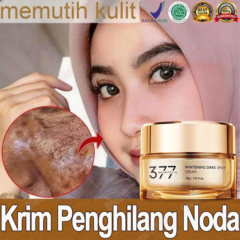 377 Krim Penghilang Flek Hitam 30g Krim Pemutih Wajah Creamwhitening Freckle Cream Niacinamide Memut