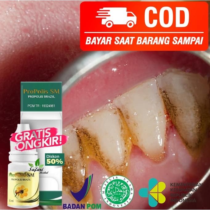 [ GERONIMO ]  Obat Pembersih Karang Gigi, Pemutih Gigi Kuning & Hitam