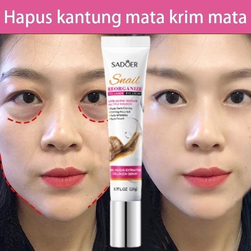 SADOER eye cream/menghilangkan mata panda/penghilang kantung mata/eye cream mata panda/serum mata pa