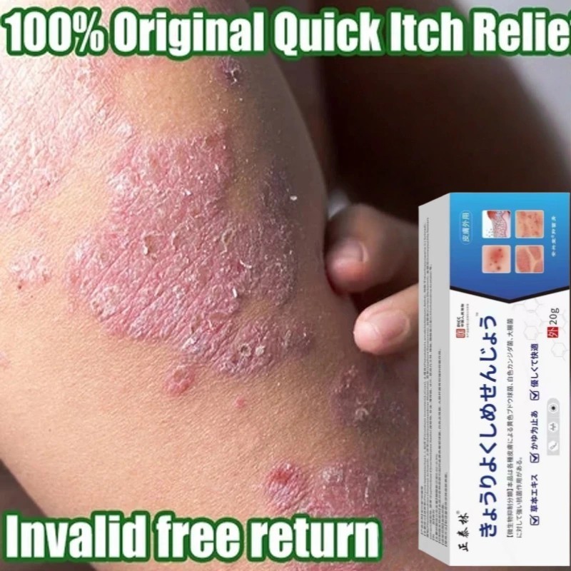 Japan Eczema Ointment Treatment cream Herbal Itching Skin Care Antibacterial Psoriasis Cream Psorias