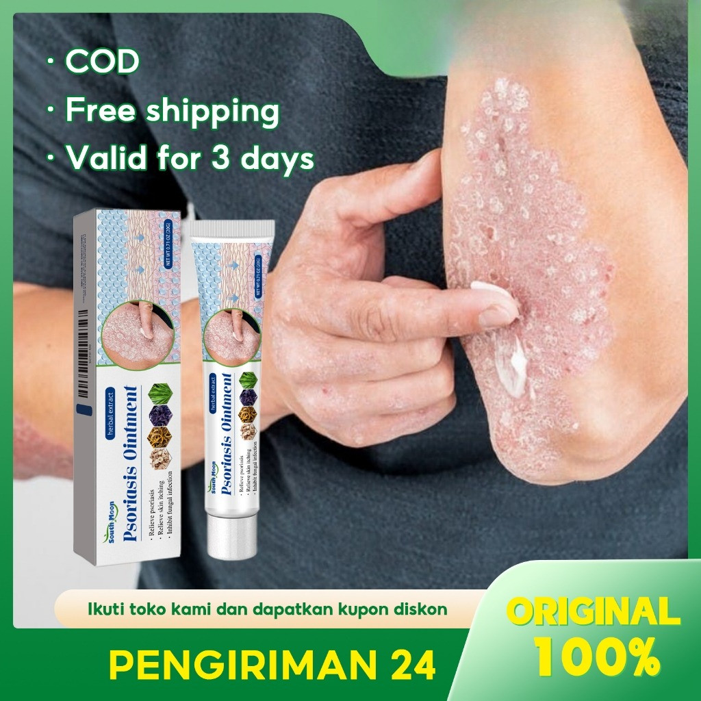 South Moon Obat Gatal 20g Obat Gatal Selangkangan Psoriasis Psoriasis Cream Obat Psoriasis Obat Gata