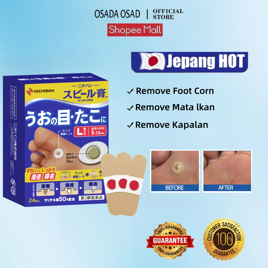 OSADA OSADI 24Pcs/Set Plester Mata Ikan /Penghilang Kutil / Penghilang Mata Ikan / Kapalan / Foot Co