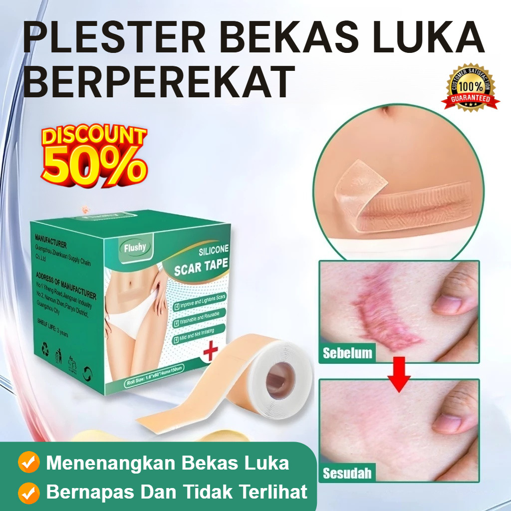 Silicone Scar Sheet Plester Bekas Luka 4cm*150cm | Plester Bekas Luka Caesar | Plester Perawatan Bek