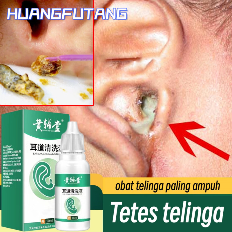 HUANGFUTANG Obat tetes telinga cairan obat telinga berdengung obat telinga tuli 20ml Cairan pembersi