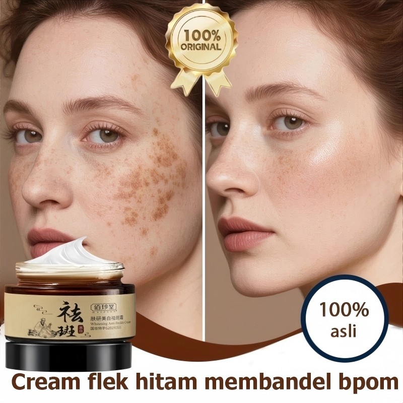 cream penghilang flek hitam salep flek hitam membandel cream flek hitam membandel 30g cream pemutih 