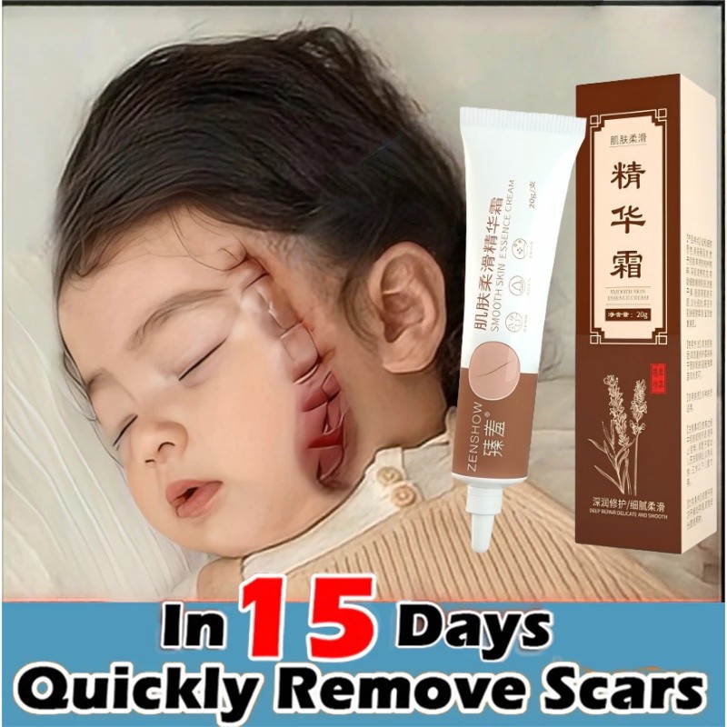 Penghilang bekas luka bayi Krim kaki hitam Penghilang bekas luka hitam koreng Menghilangkan bekas lu