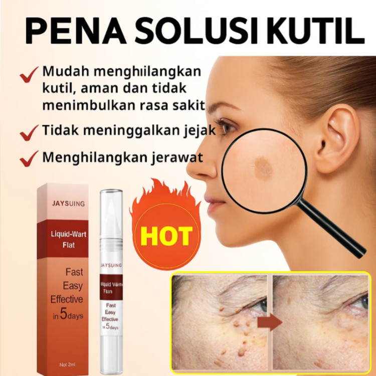 Pensil Obat Kutil Untuk Memudarkan Mole Dan Kaki Ayam / Pensil Obat Kutil Untuk Label Kulit / Perawa