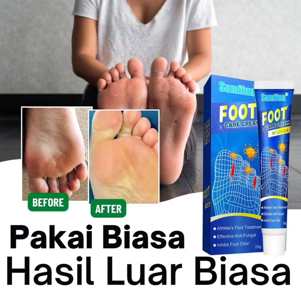 Obat Telapak Kaki Rayapan, Obat Kaki Rayapan, Obat Telapak kaki Bolong Bolong, Salep Kaki Rayapan
