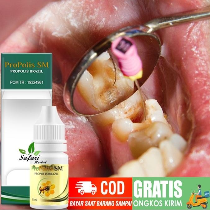 [ GERONIMO ]  Obat Gigi Berlubang, Obat Perontok Gigi Bolong, Nyeri Gigi Ngilu alami