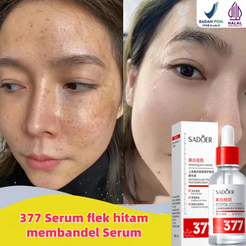 377 Serum flek hitam membandel Serum penghilang flek hitam 30ML Serum pemutih/melasma/bintik penua/A