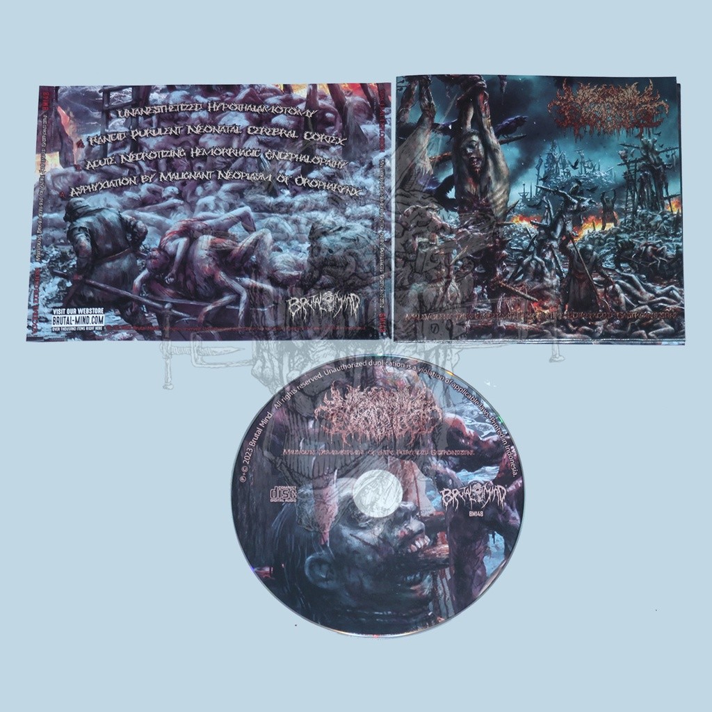 CD - VISCERAL EXPLOSION - Malevolent Dismemberment Of Entire Putrefacted Gastrointestine