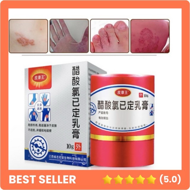 Salep Gatal Kulit Kl Bl Salep Eksim Gatal Selangkangan Jamuran Jerawat Kudis Kutu Air Panu