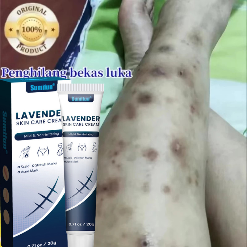 Krim Penghilang Bekas Luka, Obat Penghilang Bekas Luka Bekas Luka Jahitan, Gigitan Serangga, Bekas L