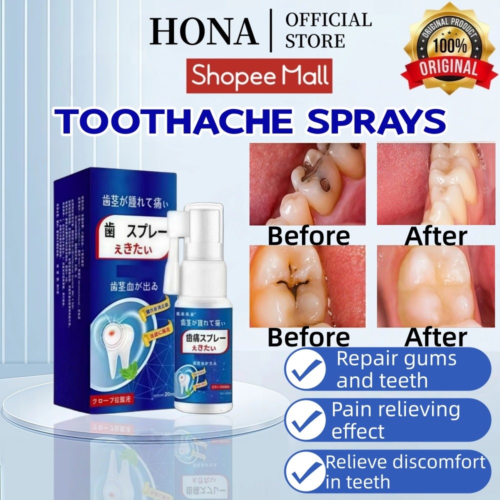 HONA Obat sakit gigi Jepang 20ml Semprotan sakit gigi Obat Sakit Gigi Berlubang Toothache Spray Peng