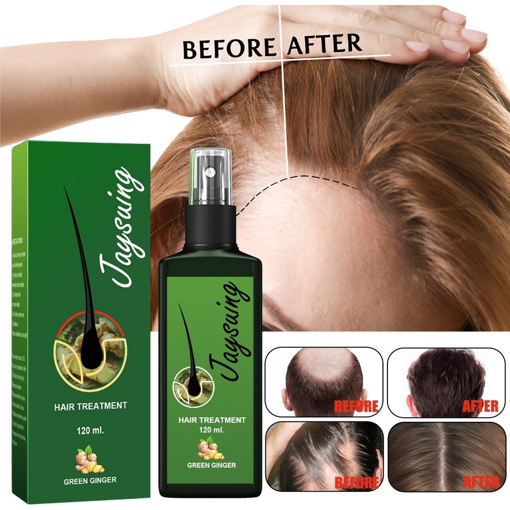 Jaysuing Rambut Serum Penumbuh Rambut 30ml Cepat Hair Growth Spray Penumbuh Rambut Penumbuh Rambut B