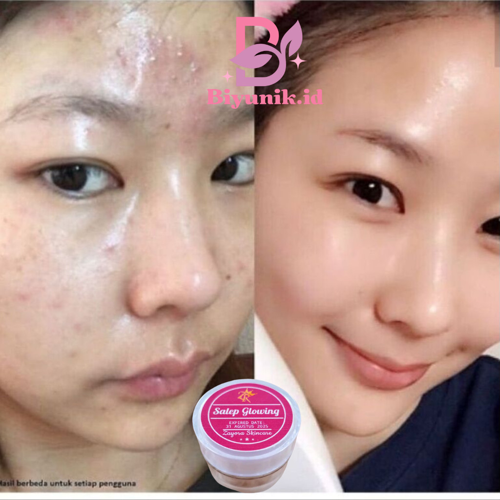 SALEP GLOWING ZAYORA 5 GR SKINCARE ZAYORA KRIM MALAM cream zayora skincare bpom ori