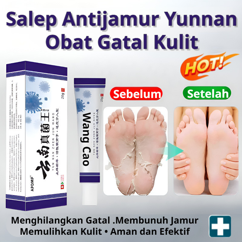 [PROMO SPESIAL/COD]/Salep Yunnan Obat Gatal/Zhenjunwang Cream Anti Bakteri/Obat Eksim Basah Kering/K