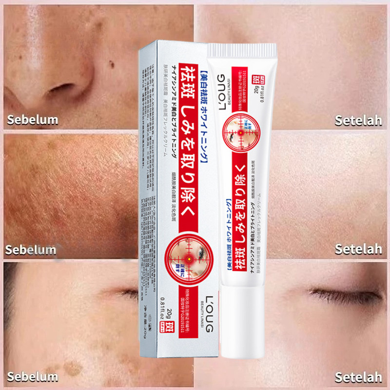 Niacinamide penghilang Flek Hitam Cream 20g Krim Pemutih anti bintik Krim pemutih wajah Krim bintik 