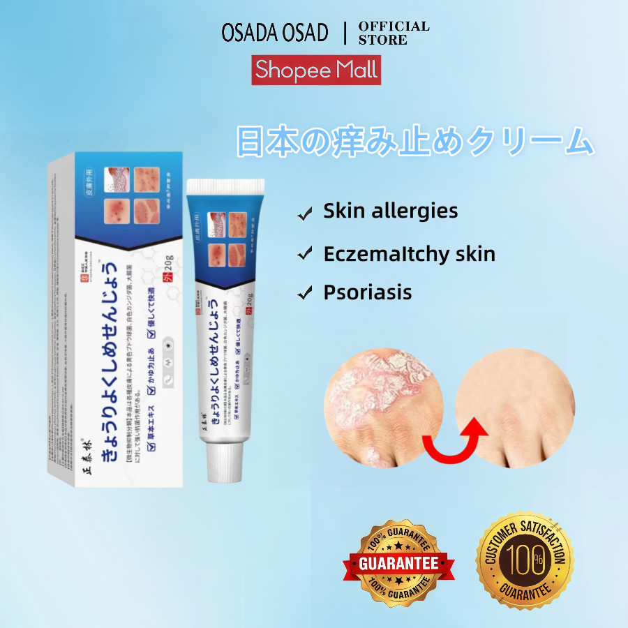 OSADA OSADI Salep gatal paling ampuh Obat psoriasis obat gatal salep kutil Obat Gatal Salep gatal Sa