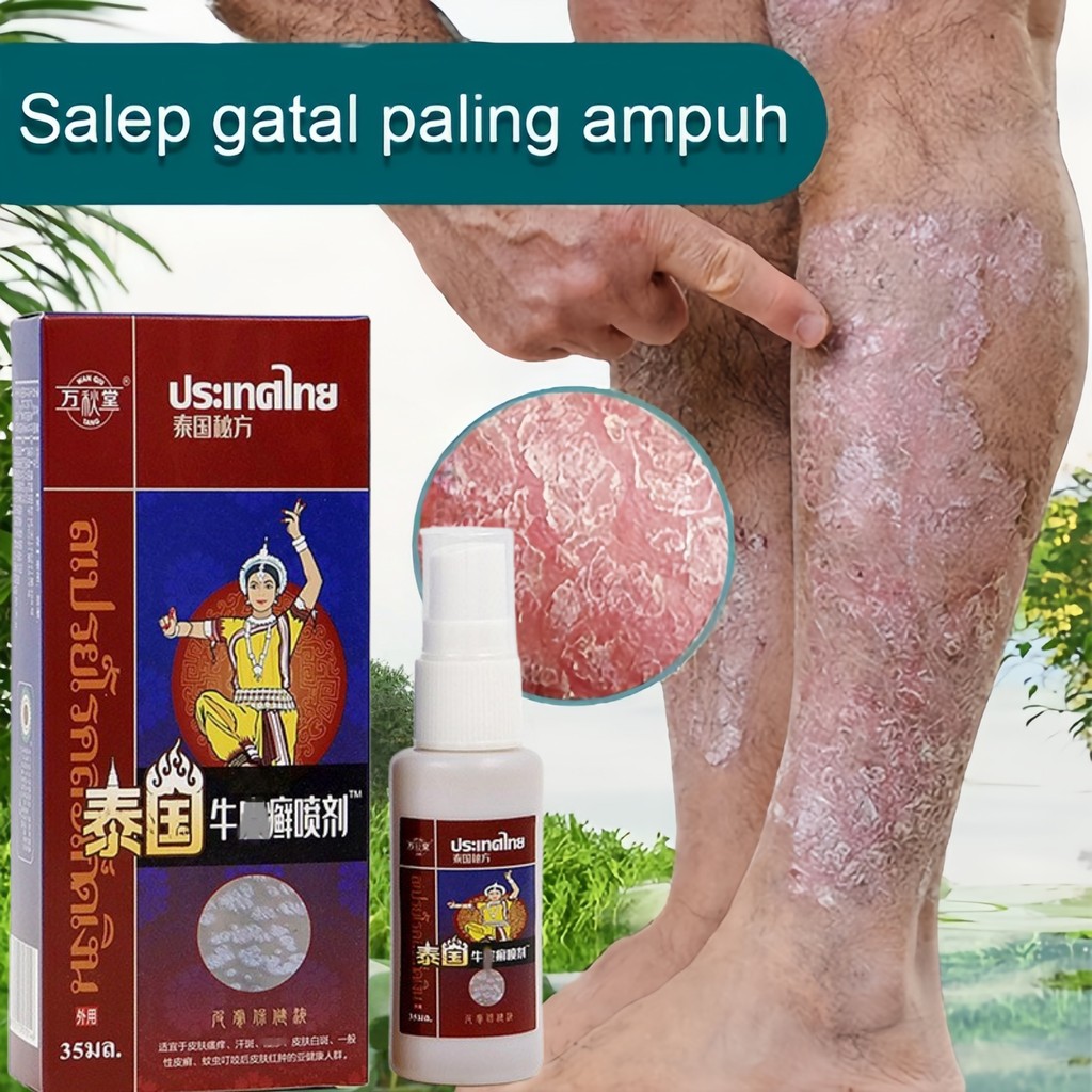 Obat Gatal Eksim Krim psoriasis Salep Khusus Psoriasis paling ampuh Kulit Kepala Psoriasis Tangan Ti