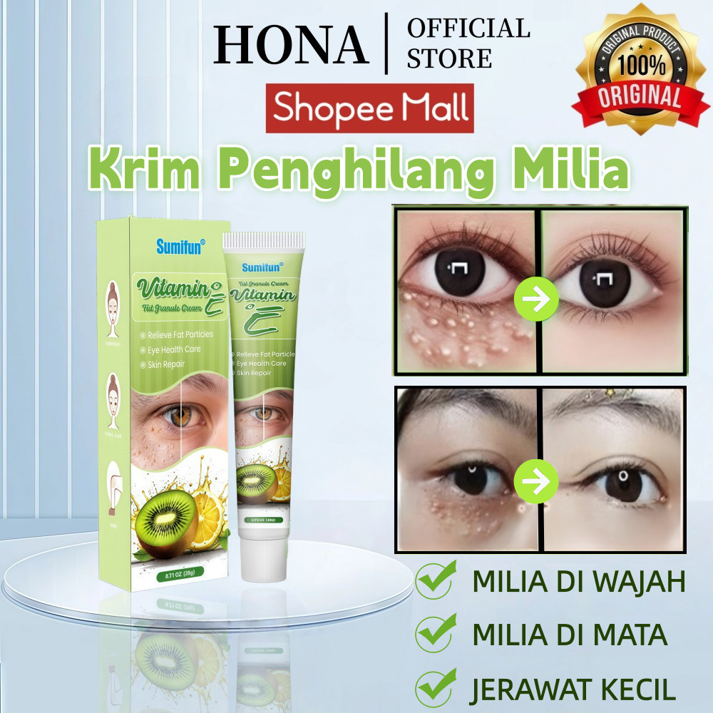 HONA Krim Penghilang Milia 20g Krim Mata Agen Penghilang Milia Obat Milia untuk Bawah Mata Krim Mili