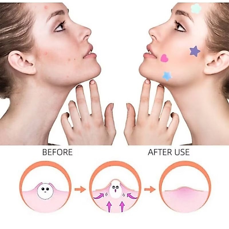 [OSM] Stiker Hydrocolloid Acne Pimple Patch Stiker Jerawat Bintang Love Colorful Murah Makassar Min 