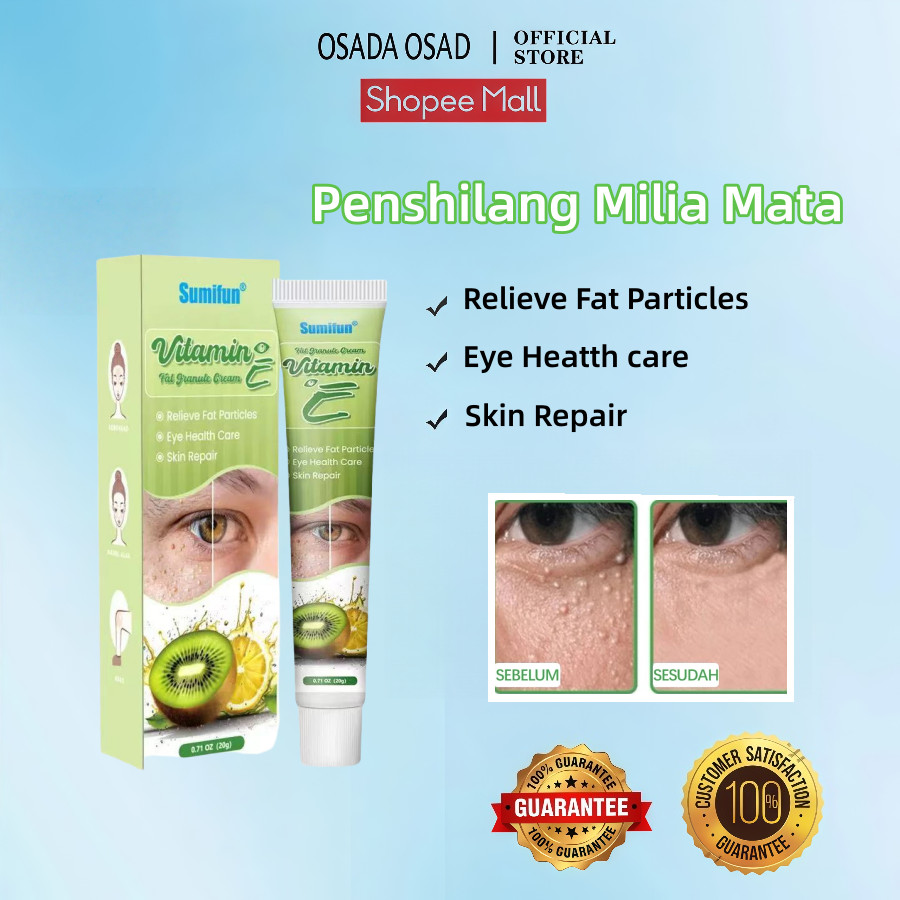 OSADA OSADI krim penghilang milia syringoma xanthelasma butiran lemak sekitar mata