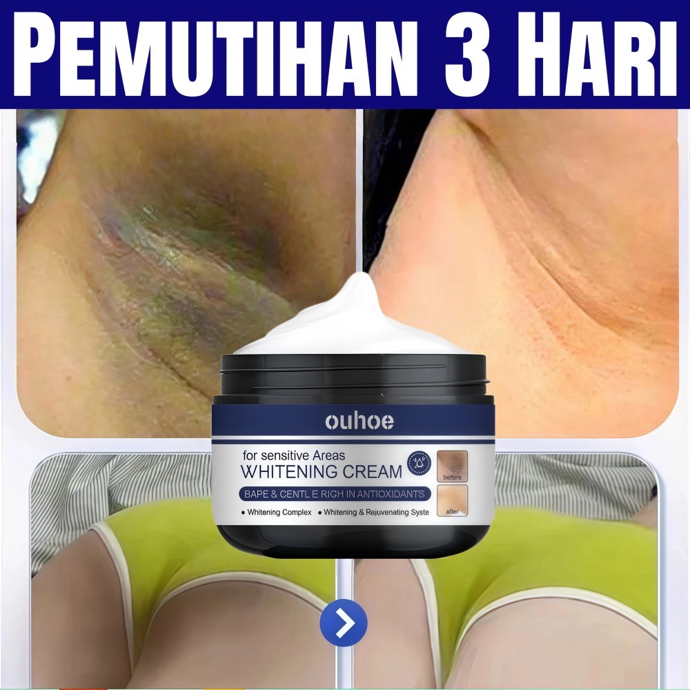 Krim Pemutih Ketiak 30g Pemutih Selangkangan Vagina Pembersih Selangkangan Hitam Krim Pemutih Ketiak