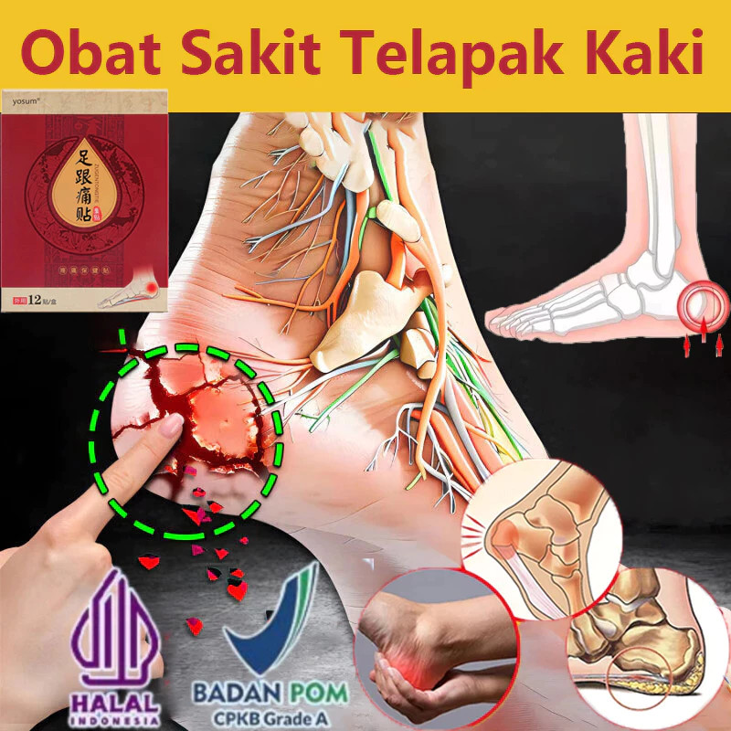 Plantar Fasciitis Terapi 12PCS Heel pain relief patch obat sakit kaki Koyo Kaki Pereda Nyeri Obat ka